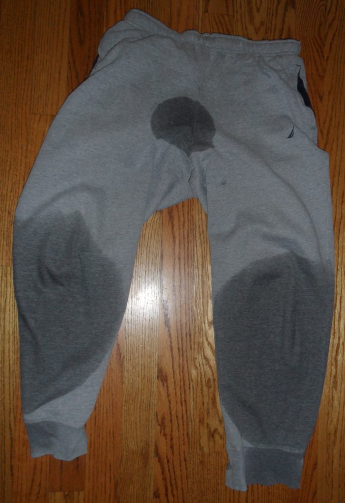 PRE-EXISTING CONDITION